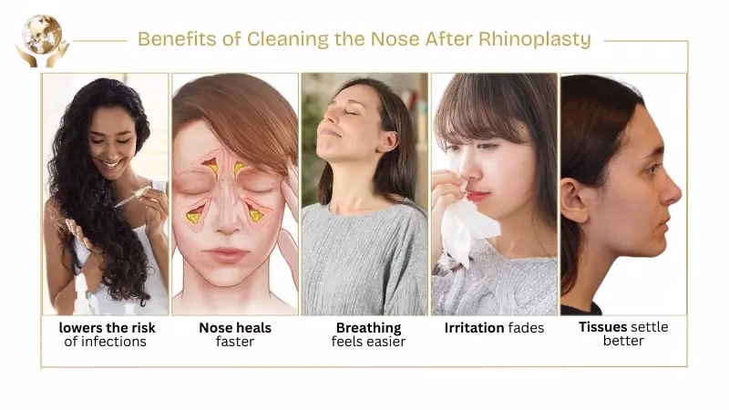 How to Clean Nose After Rhinoplasty - Mistakes to Avoid 1 Benefits of Cleaning the Nose After Rhinoplasty