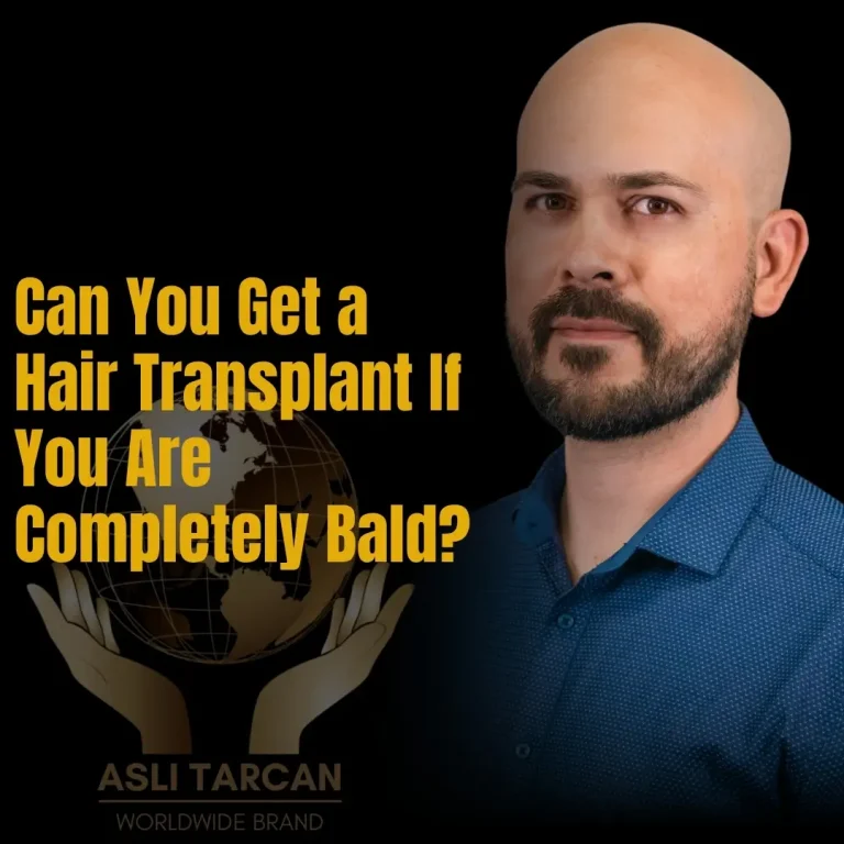 Can You Get a Hair Transplant If You Are Completely Bald