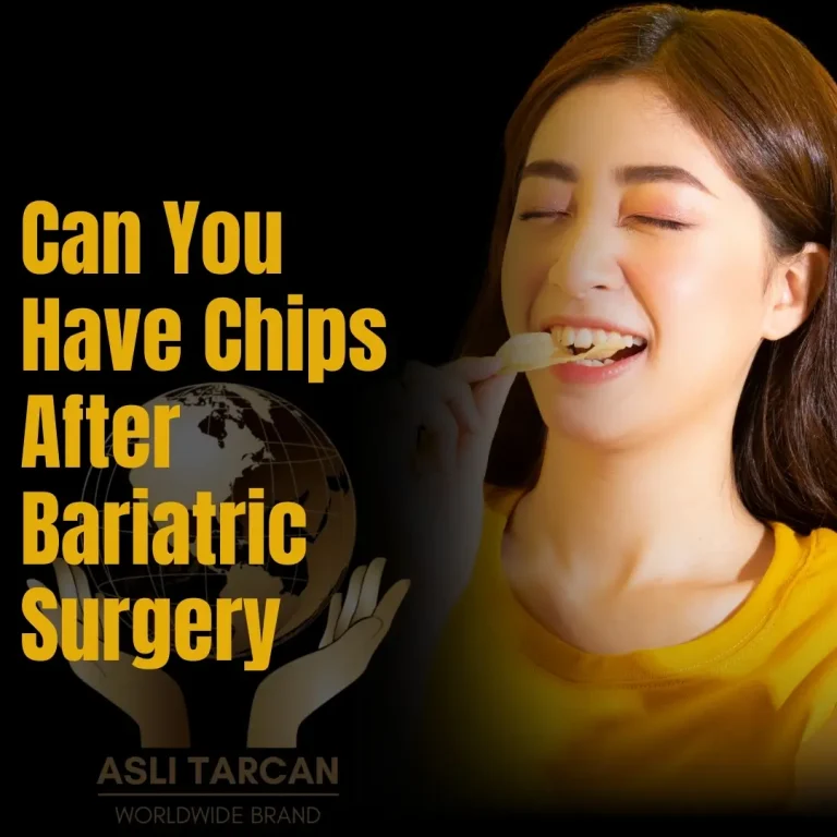 Can You Have Chips After Bariatric Surgery