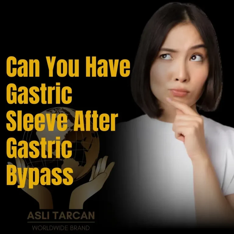 Can You Have Gastric Sleeve After Gastric Bypass
