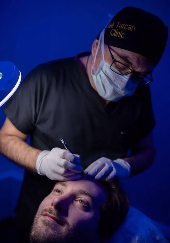Médico con mascarilla y guantes realizando un procedimiento de trasplante capilar en la línea frontal del cabello de un paciente acostado, bajo luz azul en la clínica.