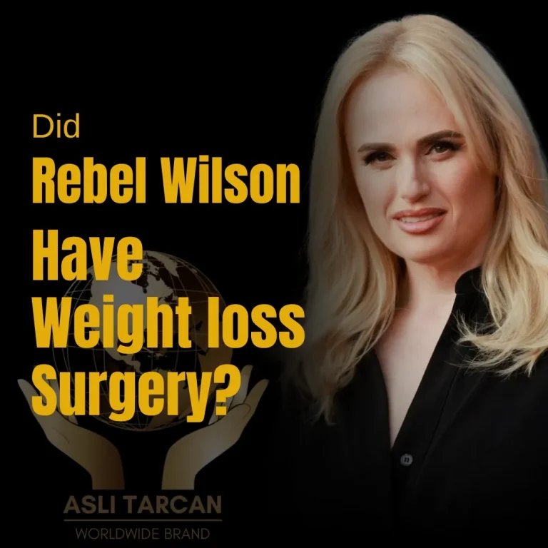 Did Rebel Wilson Have Weigh loss Surgery