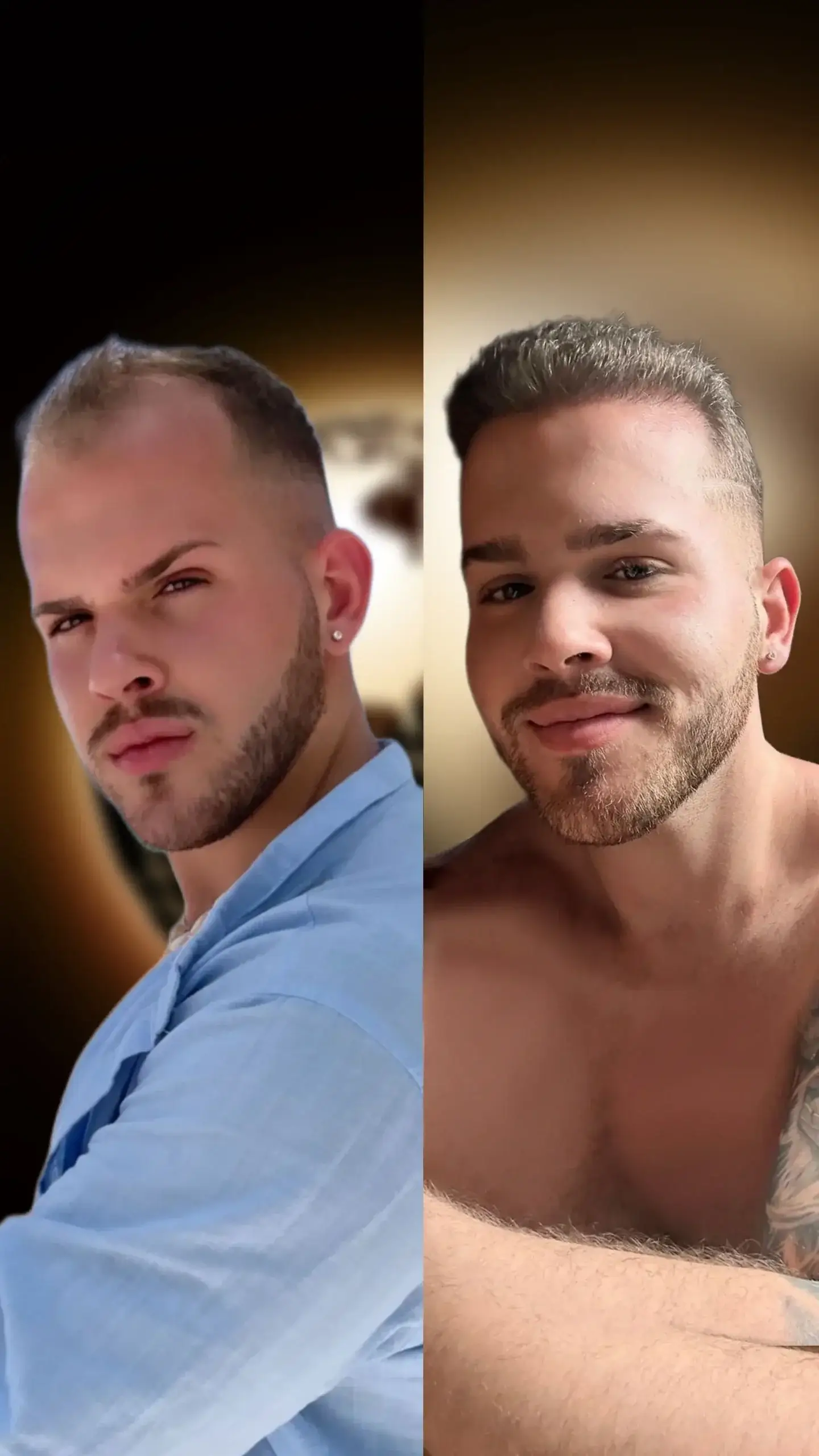 Different-Types-of-Hair-Loss-scaled Different-Types-of-Hair-Loss-scaled