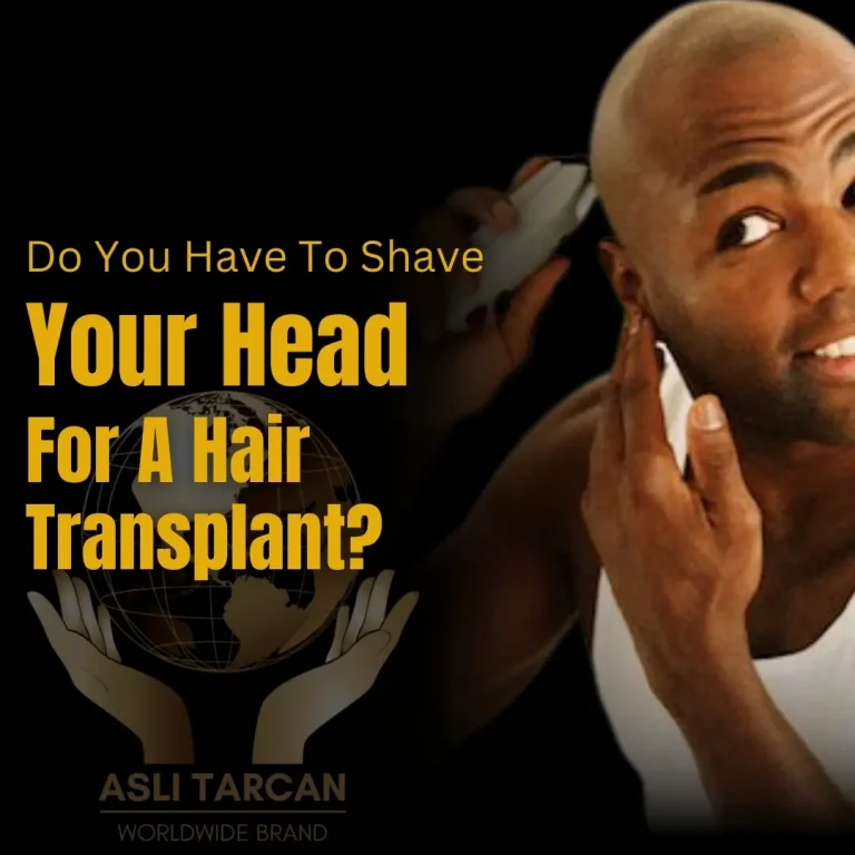 Do You Have To Shave Your Head For A Hair Transplant