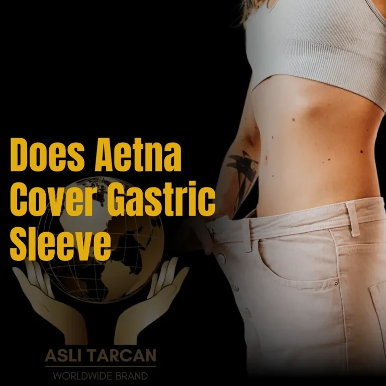 Does Aetna Cover Gastric Sleeve