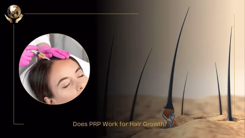 Top PRP Hair Treatment Benefits You’ll Notice Within Months 2 Does PRP Work for Hair Growth