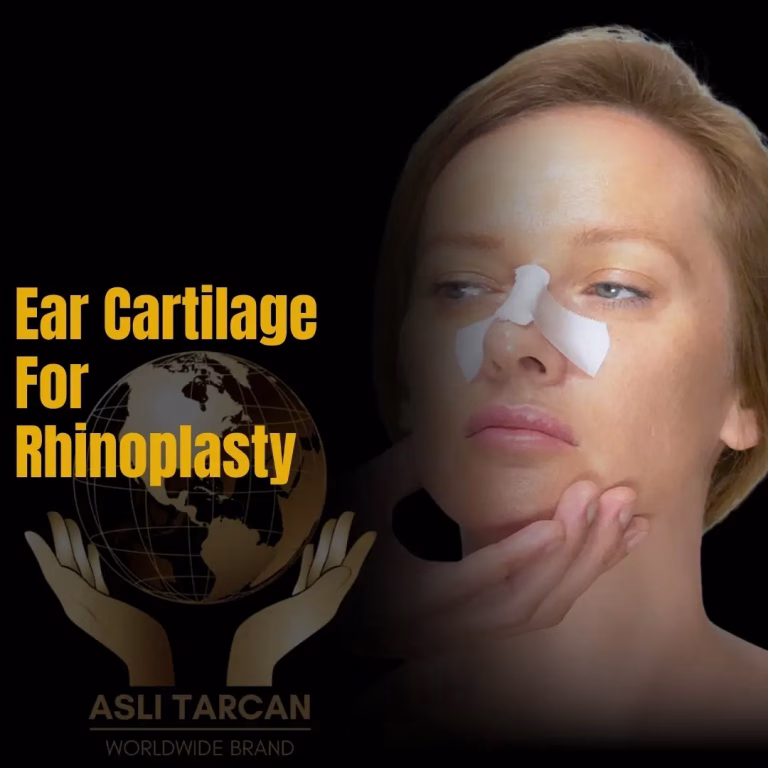 Ear Cartilage for Rhinoplasty Recovery and Results