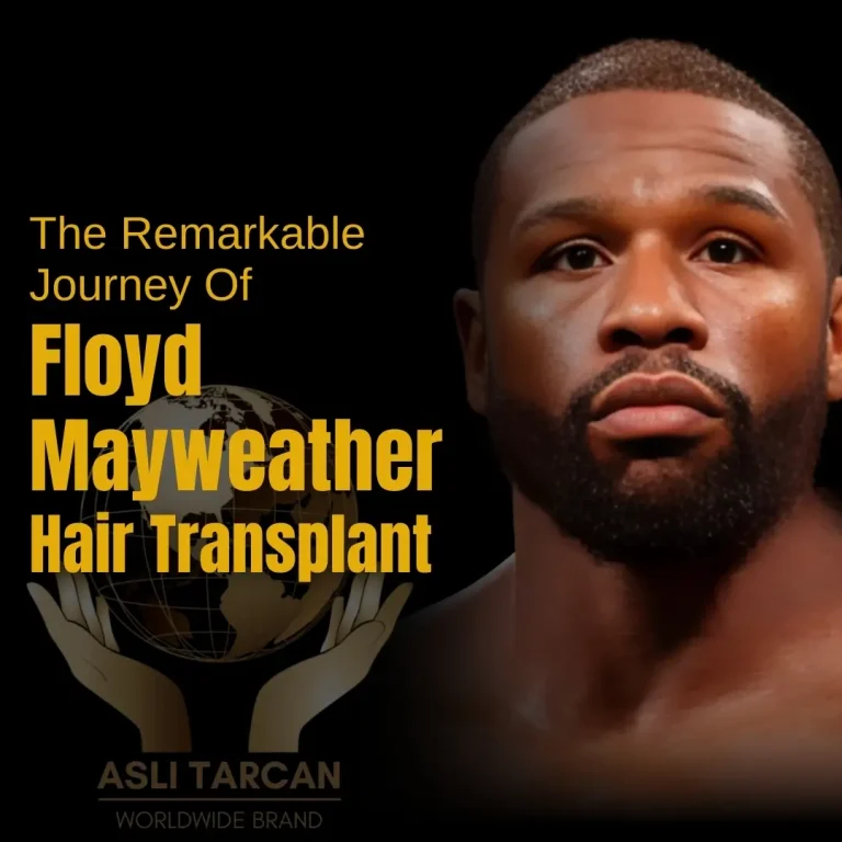 Floyd Mayweather Hair Transplant