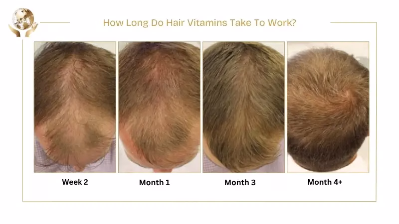 What Vitamin Should I Take for Hair Growth Naturally? 3 How Long Do Hair Vitamins Take To Work