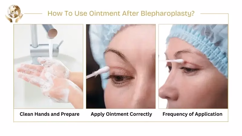 How Long to Use Ointment After Blepharoplasty - timeline guidance