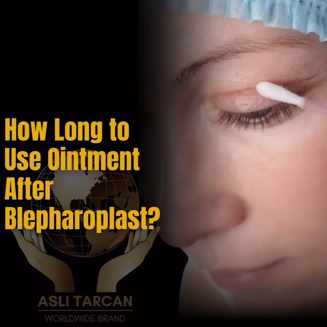 How Long to Use Ointment After Blepharoplasty