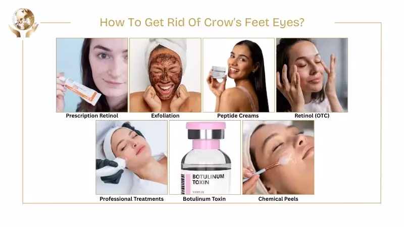 How To Get Rid Of Crow’s Feet Eyes