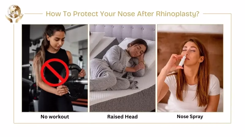 How Delicate Is Your Nose After Rhinoplasty: Dos and Don’ts 2 How To Protect Your Nose After Rhinoplasty