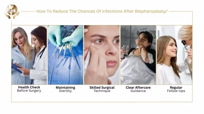 How To Reduce The Chances Of Infections After Blepharoplasty