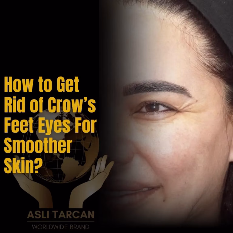 How to Get Rid of Crow’s Feet Eyes For Smoother Skin