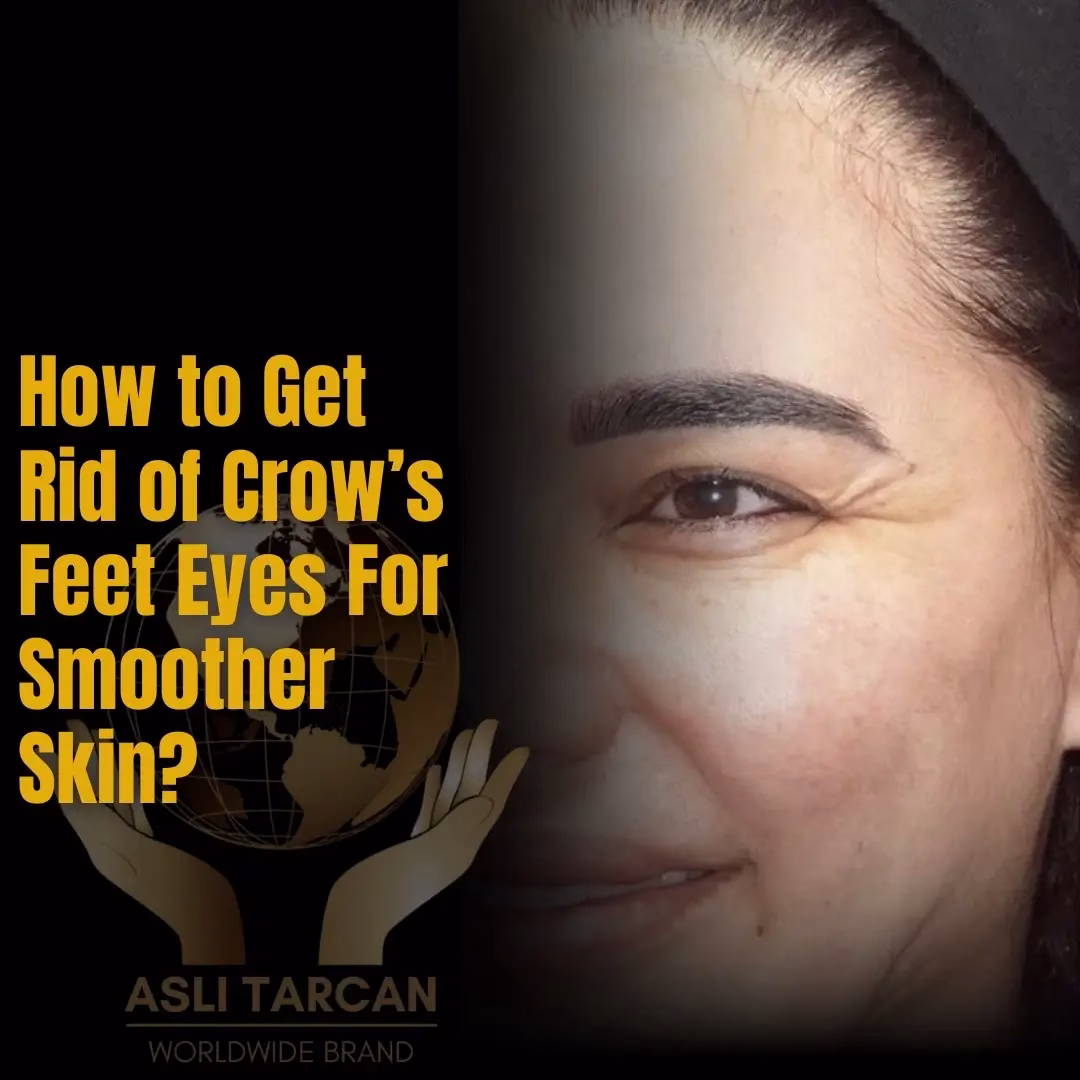 How to Get Rid of Crow’s Feet Eyes For Smoother Skin