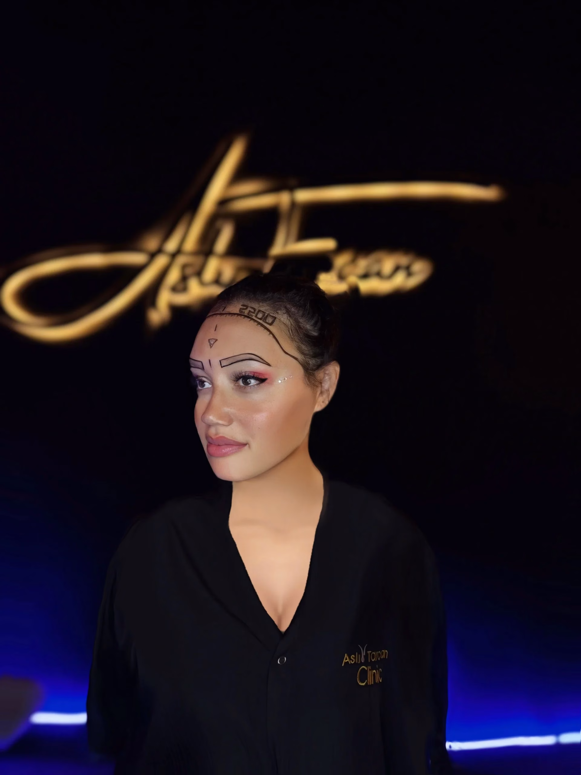 Una mujer en una clínica de trasplante capilar con marcas de guía dibujadas en la frente y la línea capilar. Lleva una bata negra de clínica y está de pie frente a un fondo oscuro con un logotipo iluminado detrás.