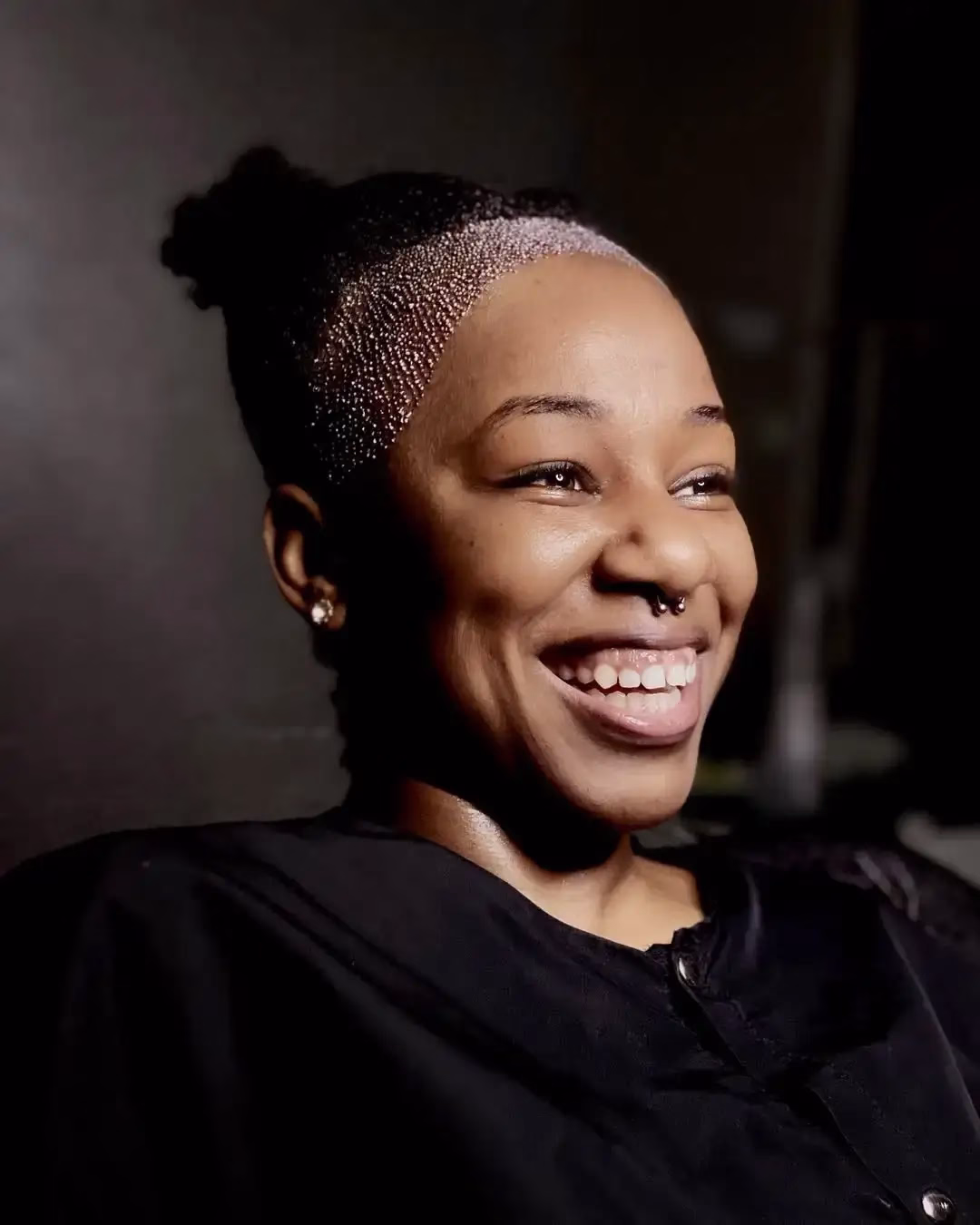 Persona sonriendo con el cabello recogido en un moño, mostrando microinjertos visibles en la zona frontal y temporal de la cabeza, lo que representa un injerto capilar sin rapar; la luz resalta el rostro y el área tratada mientras la persona parece relajada y feliz.