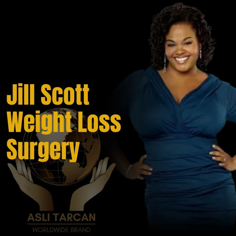 Jill Scott Weight Loss Surgery
