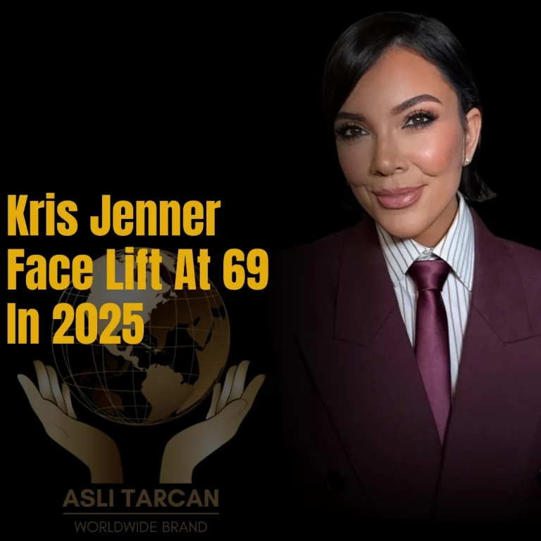 Kris Jenner Face Lift At 69 In 2025