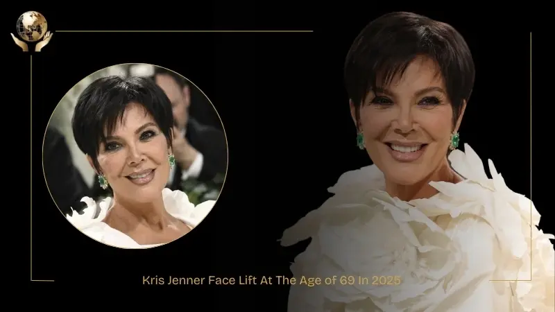 Kris Jenner Face Lift At The Age of 69 In 2025 1 Kris-Jenner-Face-Lift-in-May-2025