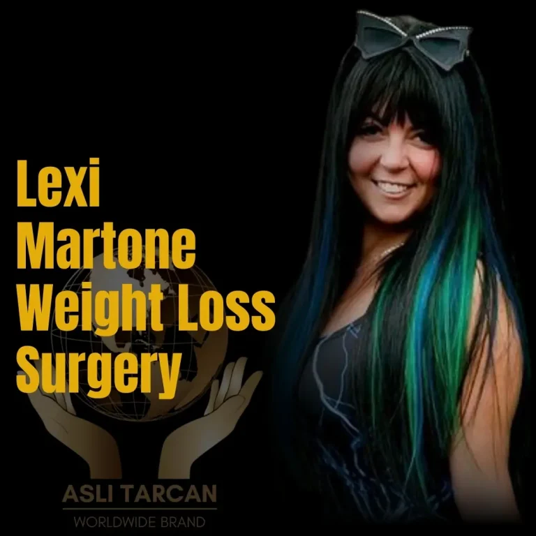 Lexi Martone Weight Loss Surgery