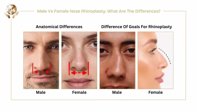 Male Vs Female Nose Rhinoplasty - Differences You Must Know 1 Male Vs Female Nose Rhinoplasty What Are The Differences