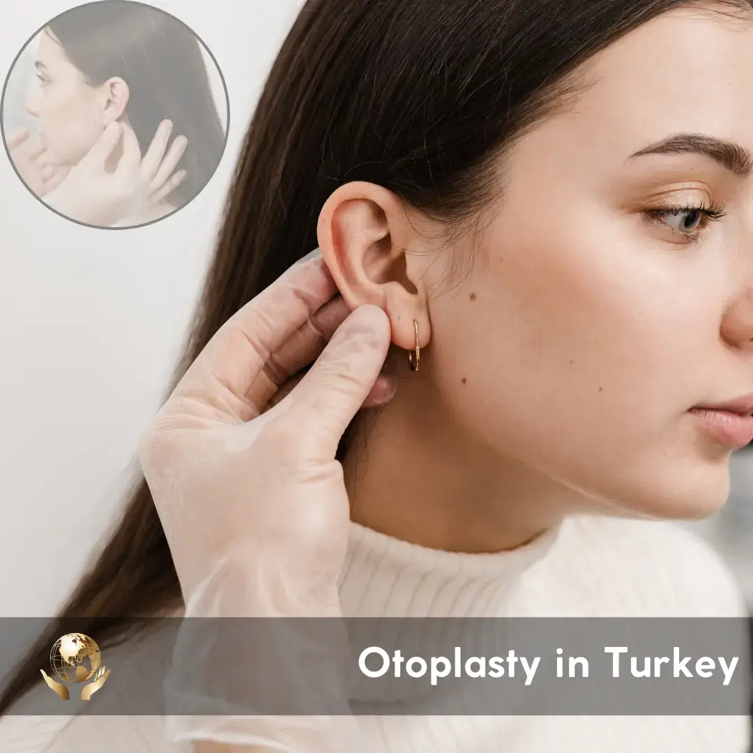 3 Otoplasty in Turkey