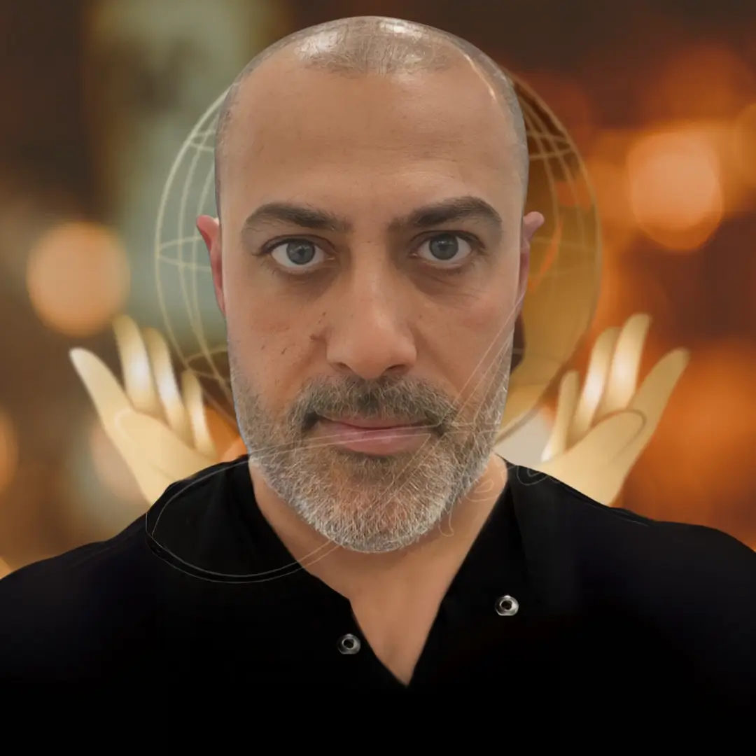 Hair Transplant Before & After