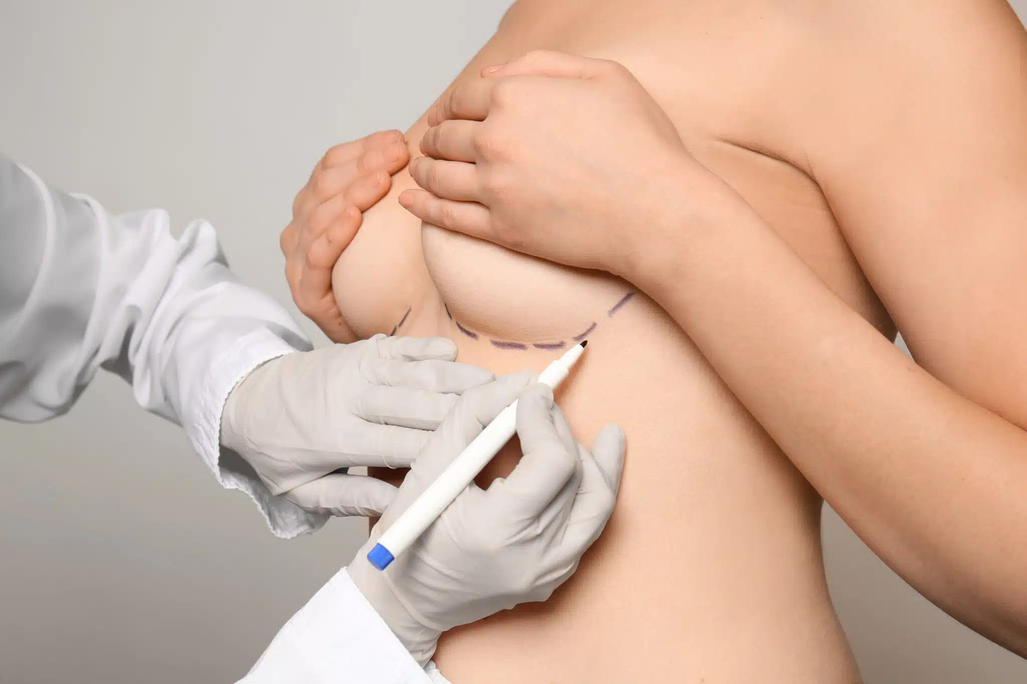 Post-Procedure Care