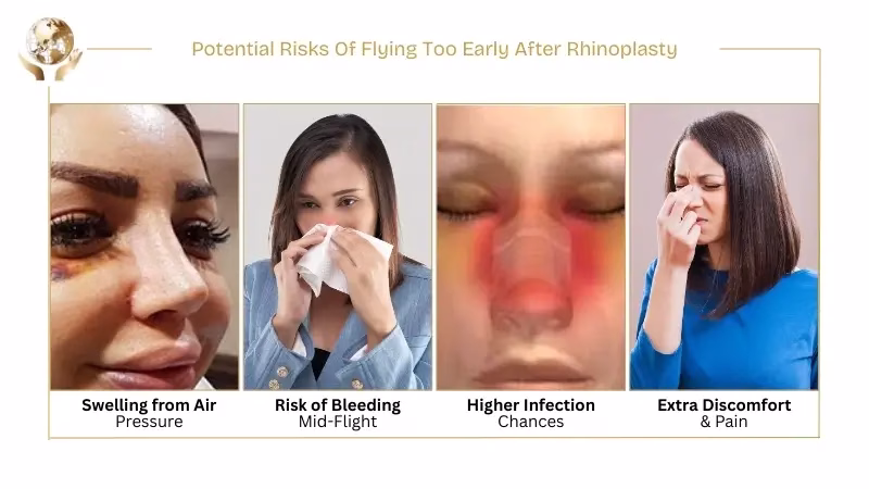When to Fly After Rhinoplasty - International Travel Concerns 1 Potential Risks Of Flying Too Early After Rhinoplasty