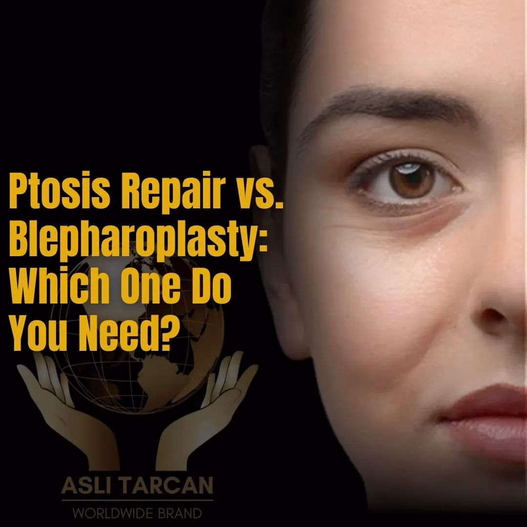 Ptosis Repair vs. Blepharoplasty - Which One Do You Need