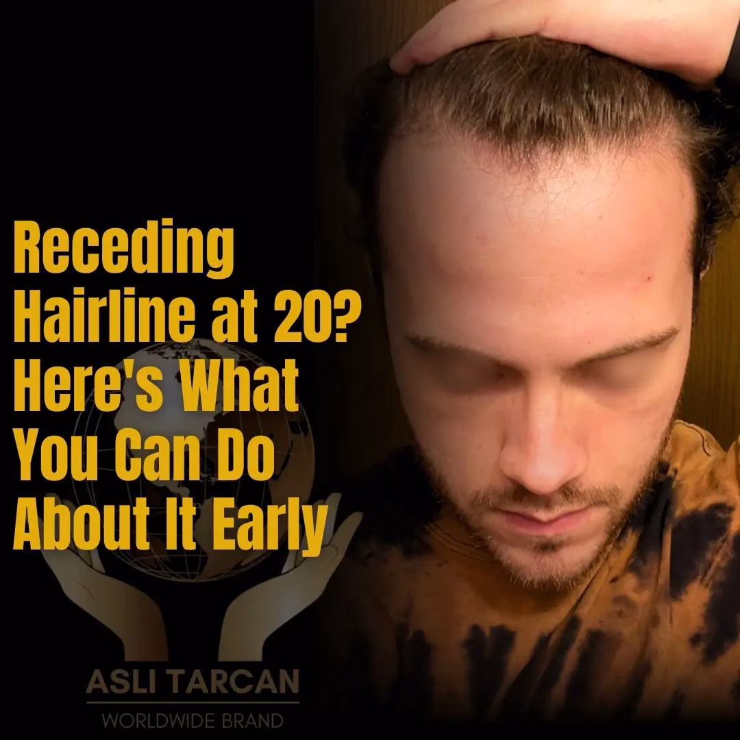 Receding Hairline at 20 What You Can Do About It Early