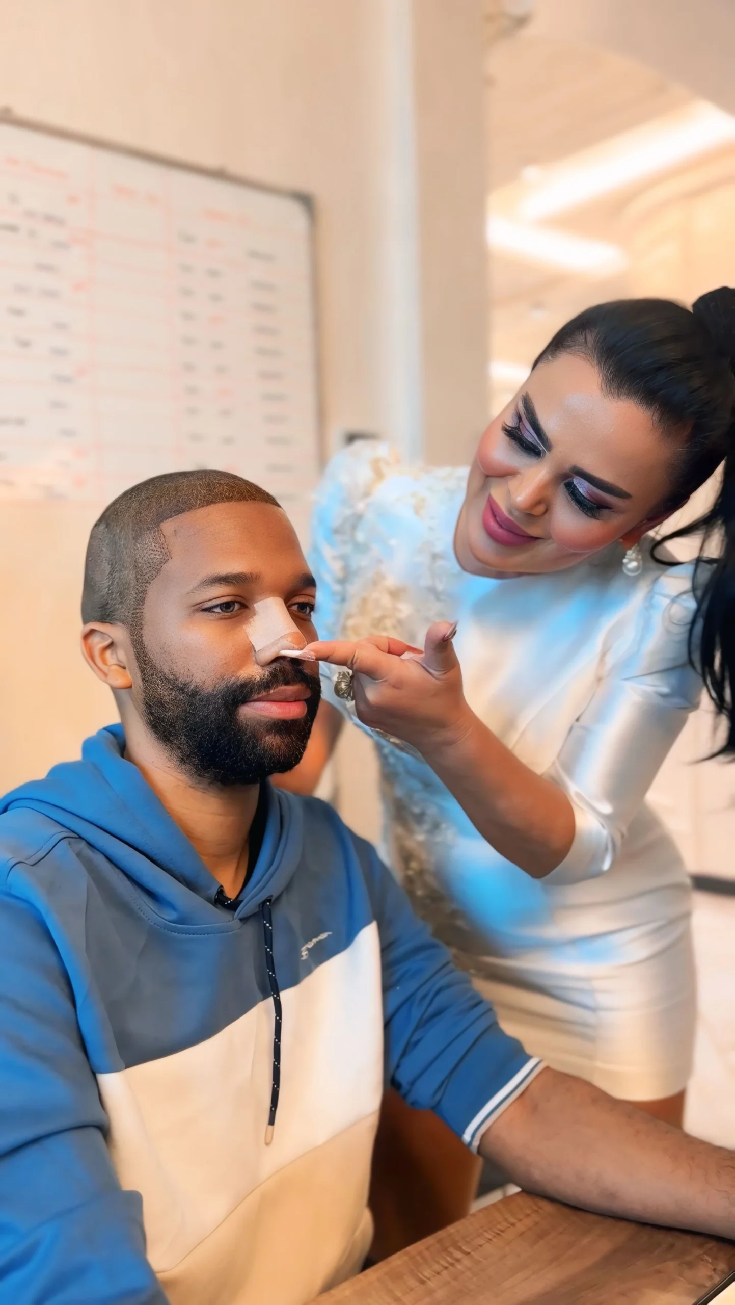 5 Revision Rhinoplasty