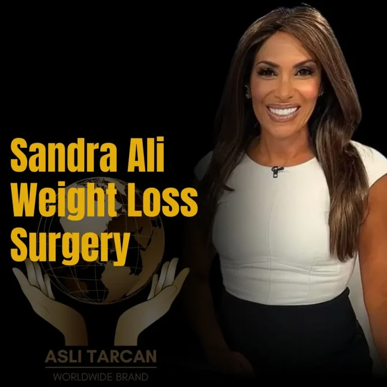 Sandra Ali Weight Loss Surgery
