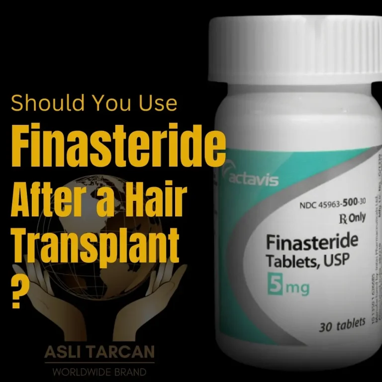 Should You Use Finasteride After a Hair Transplant