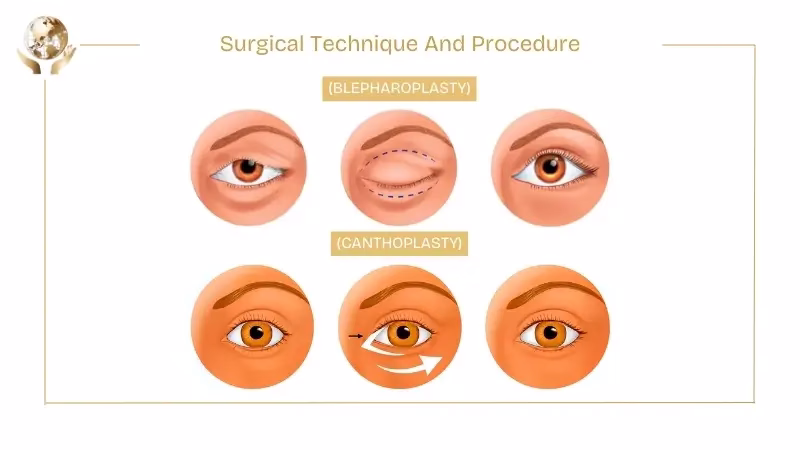 Surgical Technique And Procedure