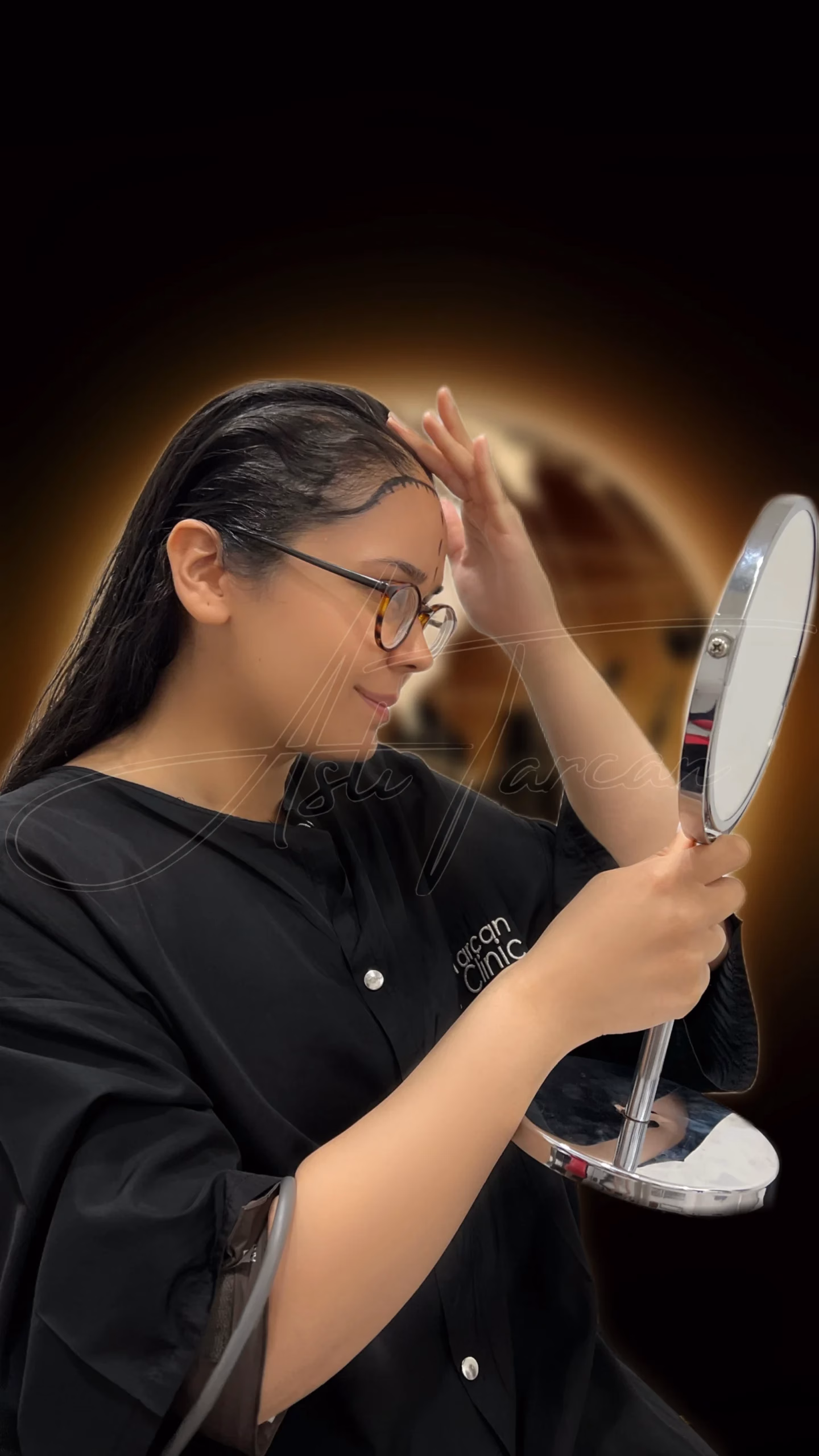 Una mujer en una clínica capilar se mira cuidadosamente en un espejo de mano mientras toca su línea frontal del cabello. Lleva una bata clínica negra con el logo de la clínica y tiene el cabello húmedo, sugiriendo un tratamiento capilar o procedimiento reciente. El fondo es oscuro con un brillo cálido detrás de ella, destacándola en la escena.