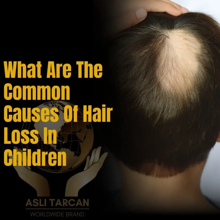 What Are The Common Causes Of Hair Loss In Children