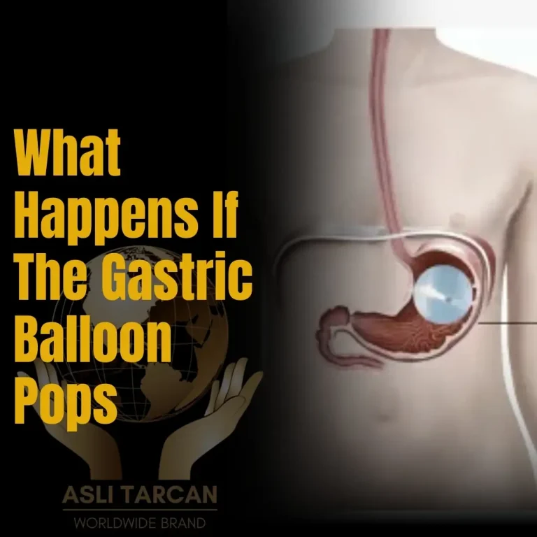 What Happens If The Gastric Balloon Pops