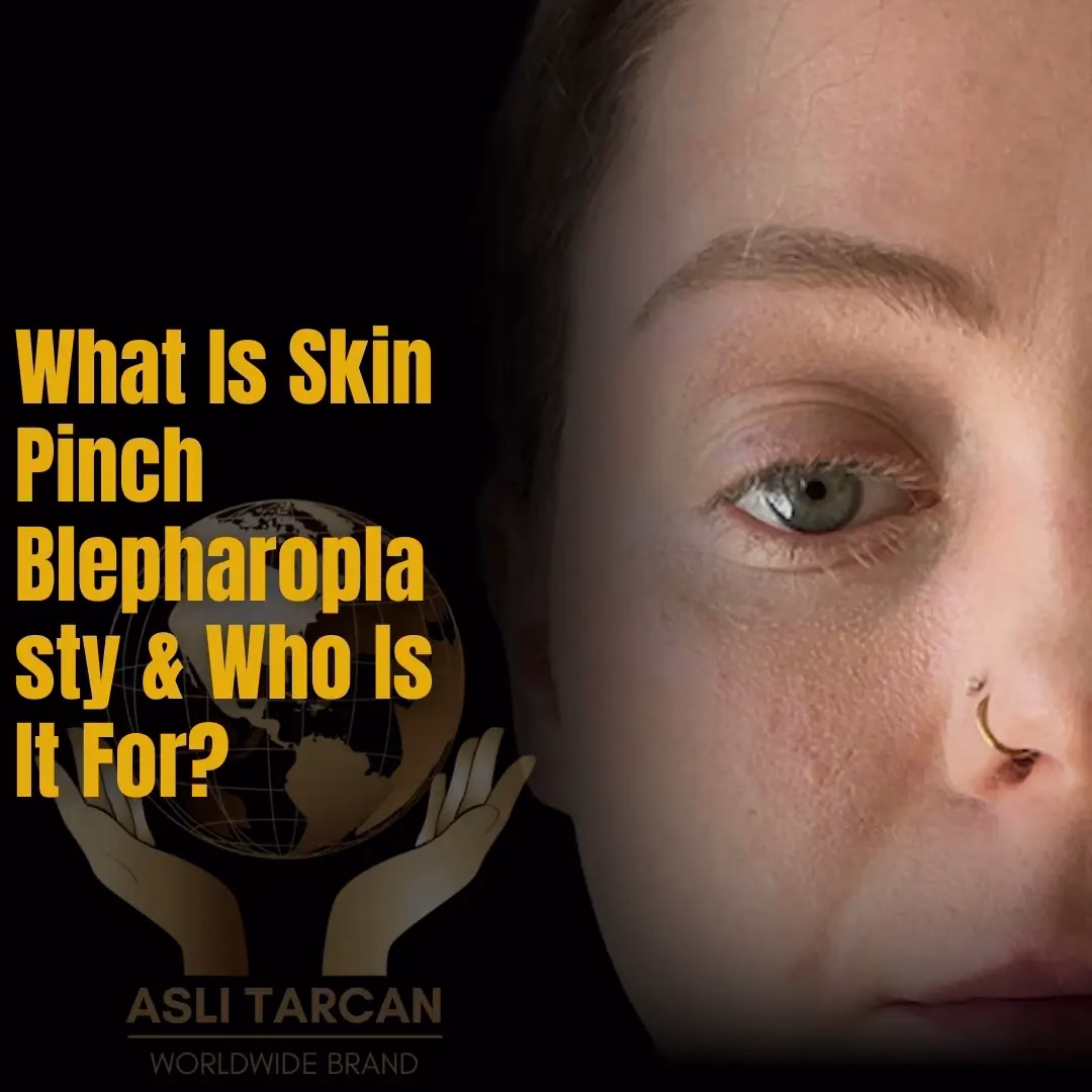 What Is Skin Pinch Blepharoplasty & Who Is It For