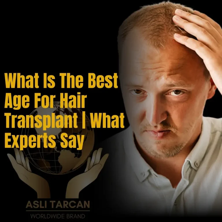 What Is The Best Age For Hair Transplant