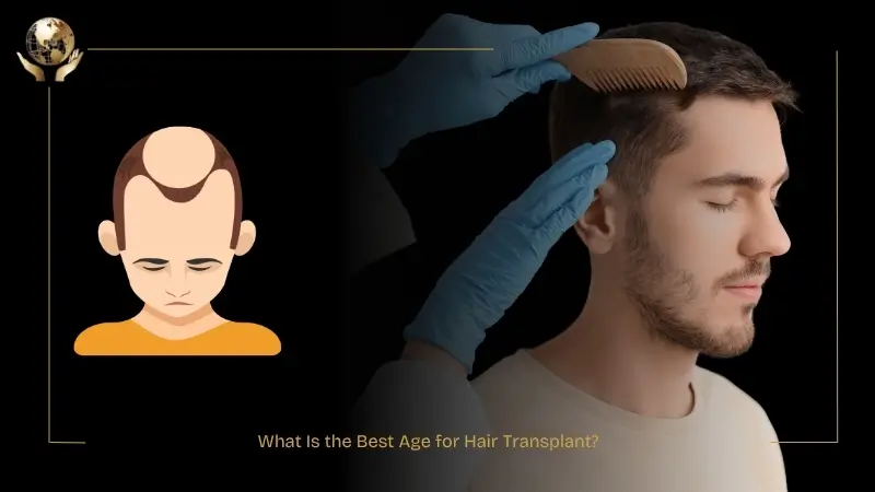 What Is The Best Age For Hair Transplant - Expert Advice What Is The Best Age For Hair Transplant - Expert Advice
