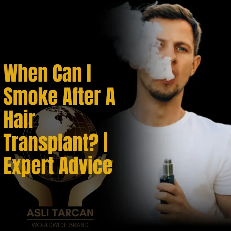 When Can I Smoke After A Hair Transplant Expert Advice