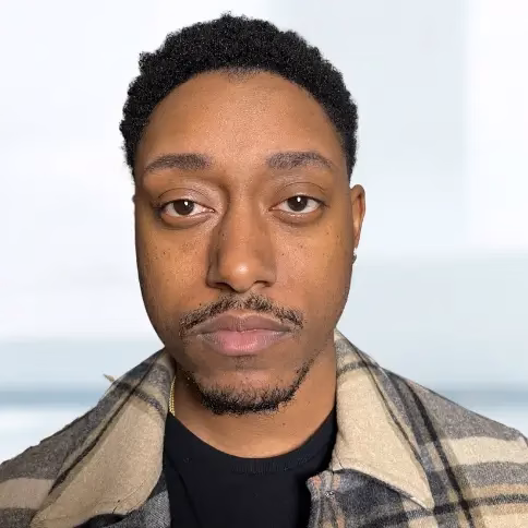 8 When do you need beard transplant