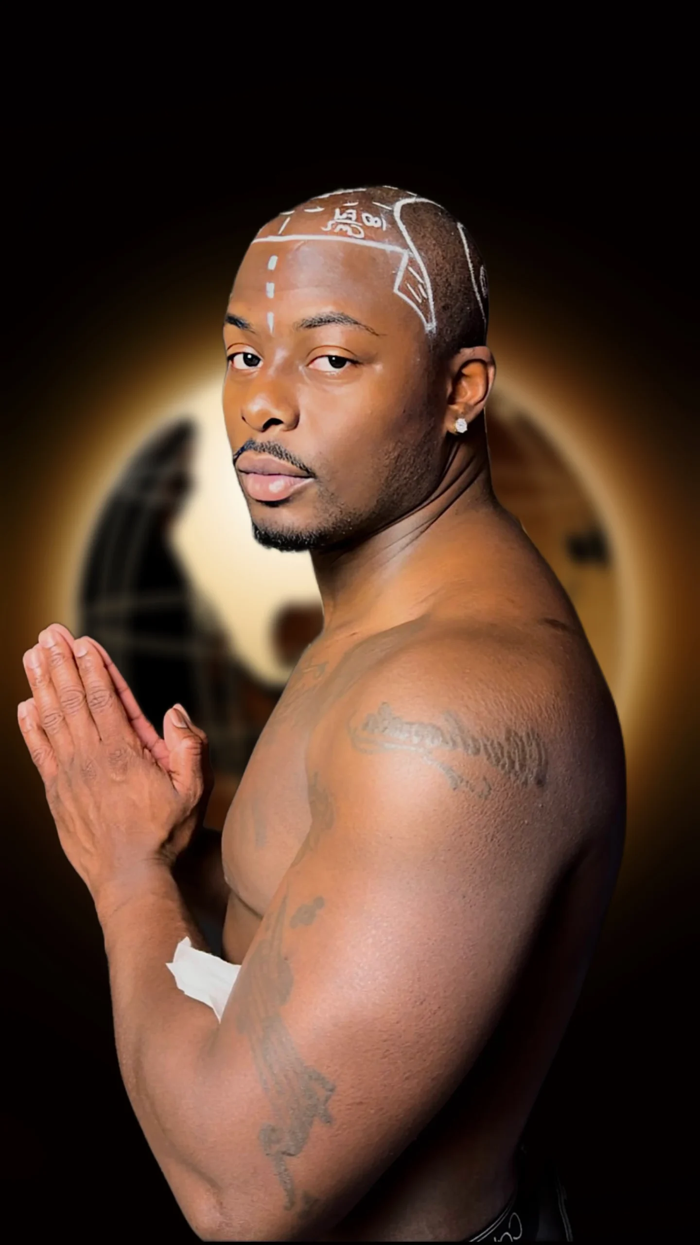 afro hair transplant turkey