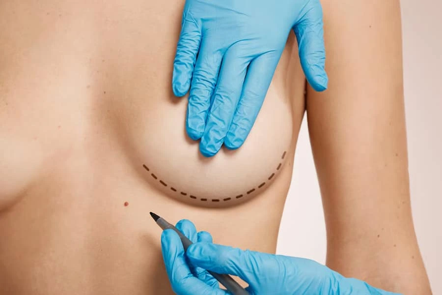 breast-reduction-surgery