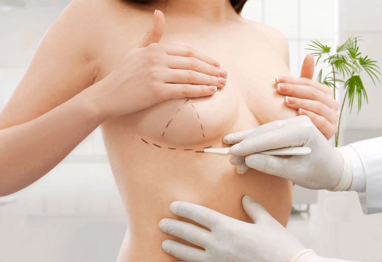 breast-reduction-turkey