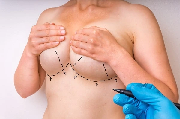 breast
