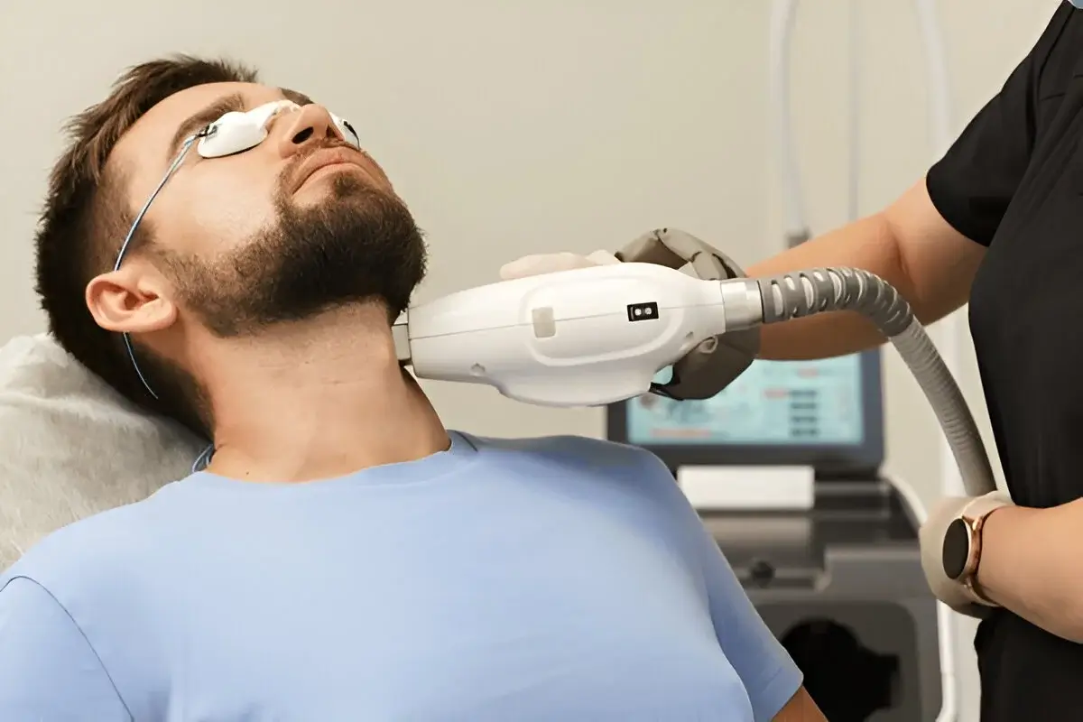 face hair removal men